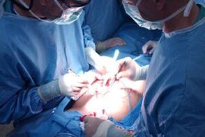 Carrying out an operation to increase the penis
